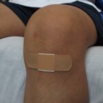 Jak przyspieszyć gojenie ran: kluczowe czynniki i skuteczne strategie